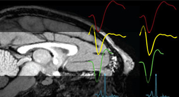 Image of brain